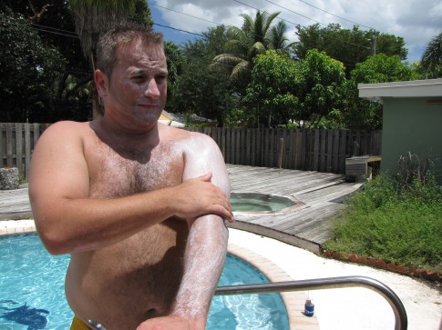 IMG_5645 Emack and his sunscreen.